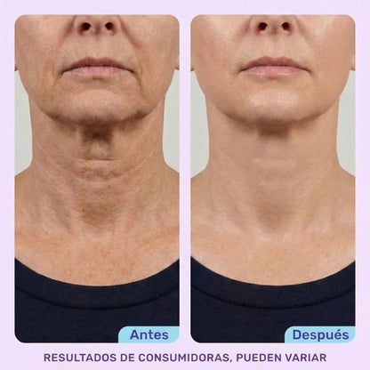 Crema Reafirmante y Lifting para el Cuello