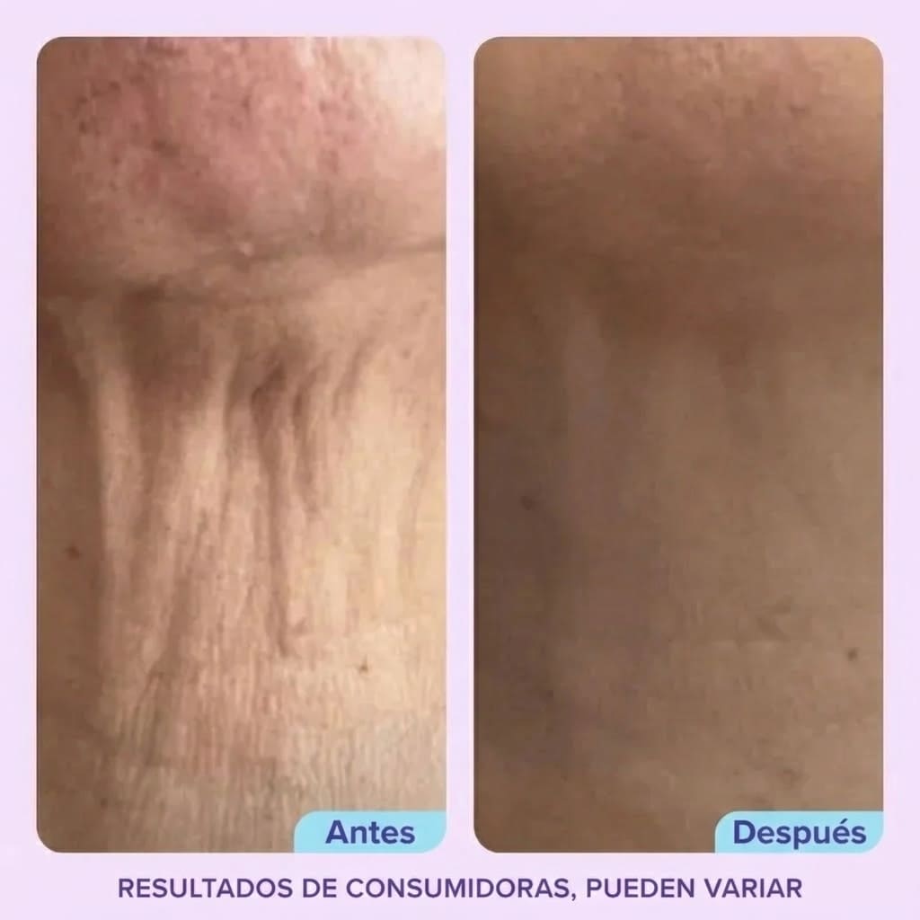 Crema Reafirmante y Lifting para el Cuello