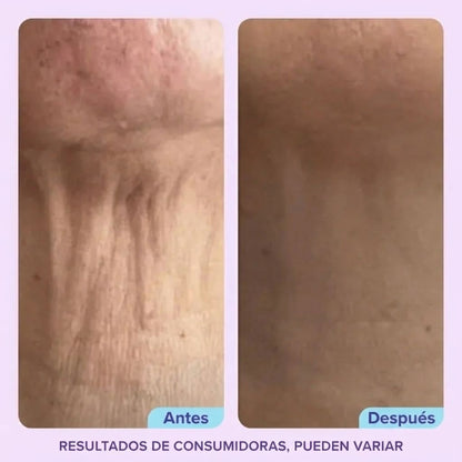 Crema Reafirmante y Lifting para el Cuello